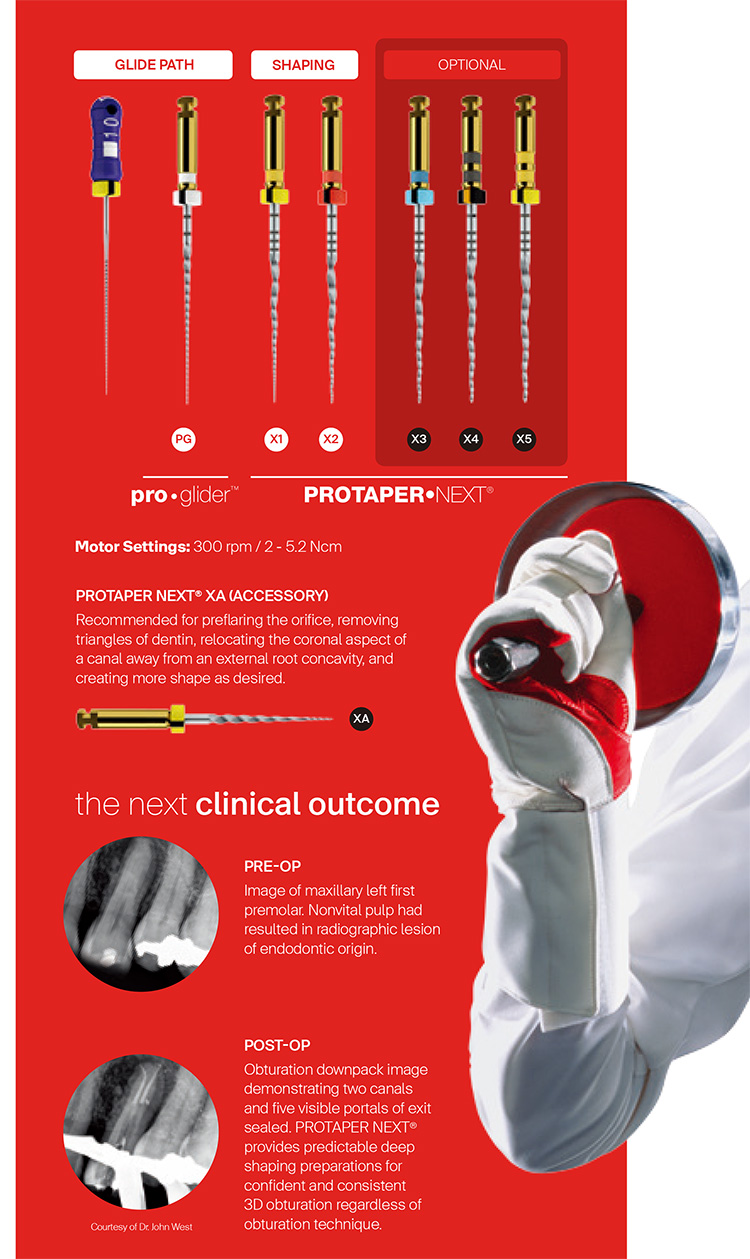 Protaper Next Endodontic File